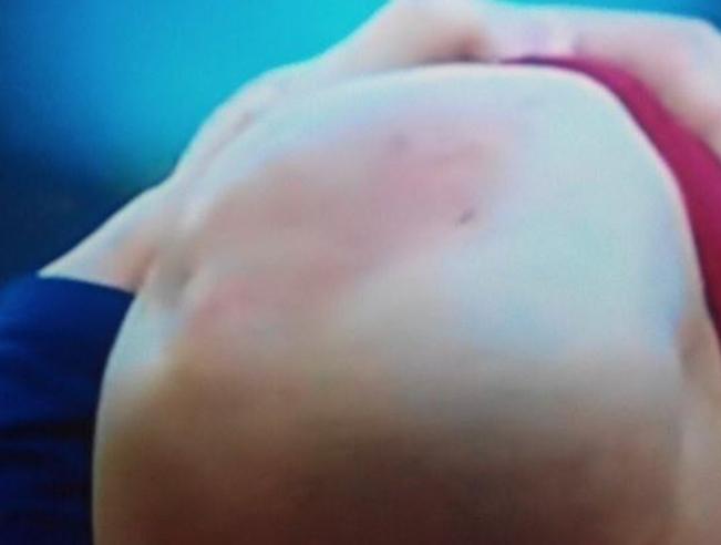 asi-quedo-la-rodilla-de-messi-tras-la-entrada-de-filipe-luis